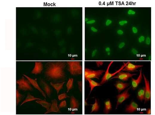 H2AK5ac Antibody in Immunocytochemistry (ICC/IF)