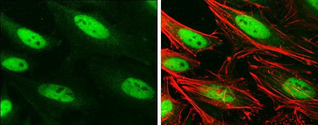 BRG1 Antibody in Immunocytochemistry (ICC/IF)