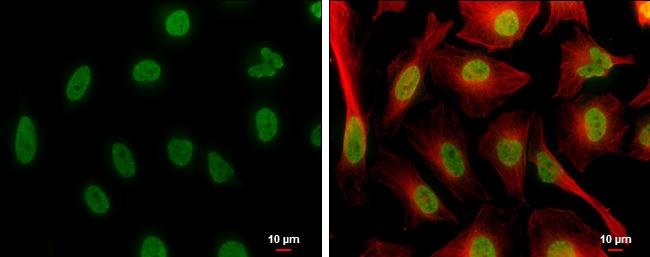 H4K8ac Antibody in Immunocytochemistry (ICC/IF)