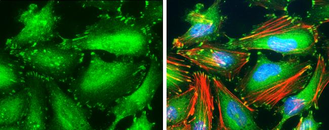 Non-Phospho-Paxillin (Tyr118) Antibody in Immunocytochemistry (ICC/IF)