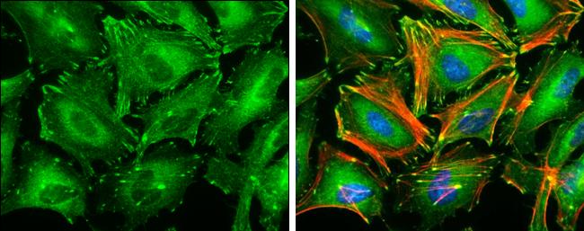 Paxillin Antibody in Immunocytochemistry (ICC/IF)