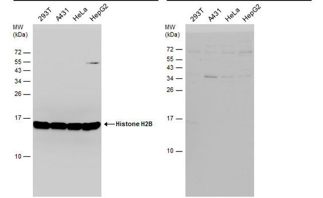 Histone H2B Antibody in Western Blot (WB)