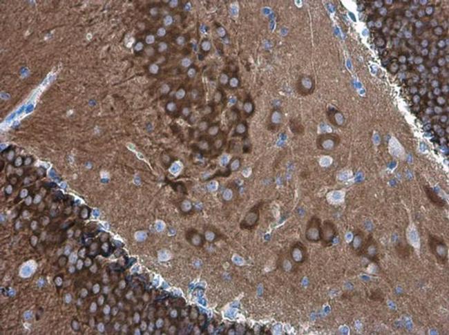 PYK2 Antibody in Immunohistochemistry (Paraffin) (IHC (P))