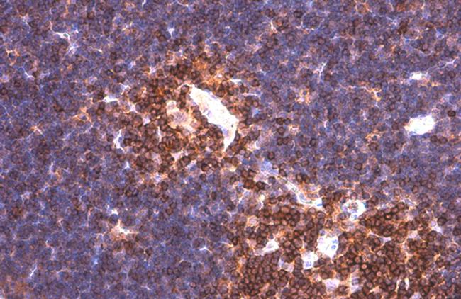 PYK2 Antibody in Immunohistochemistry (Paraffin) (IHC (P))