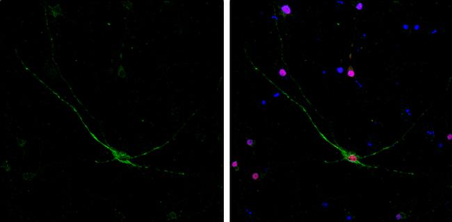 NF-H Antibody in Immunocytochemistry (ICC/IF)