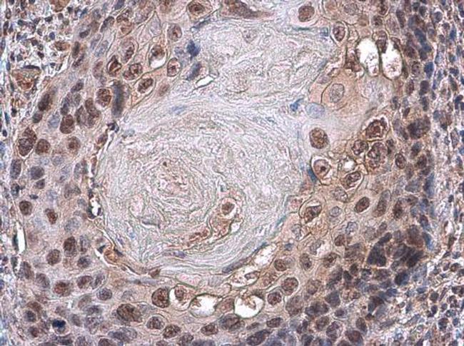 PAX3 Antibody in Immunohistochemistry (Paraffin) (IHC (P))