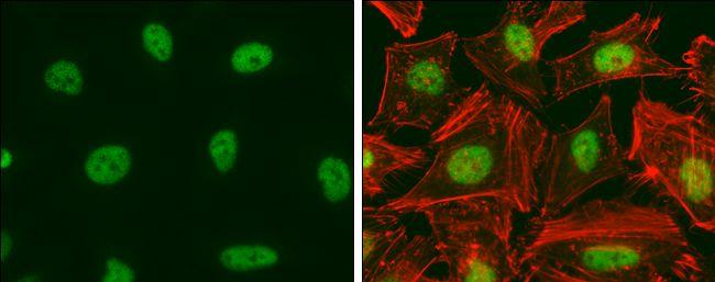 E2F1 Antibody in Immunocytochemistry (ICC/IF)