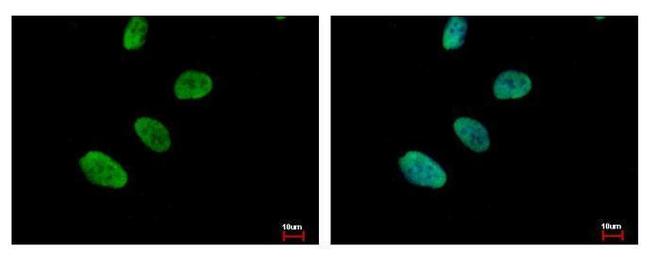 Ku80 Antibody in Immunocytochemistry (ICC/IF)