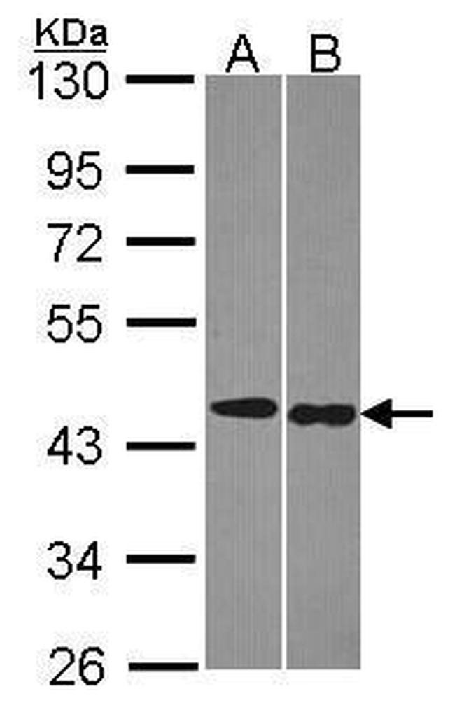 TRF1 Antibody in Western Blot (WB)