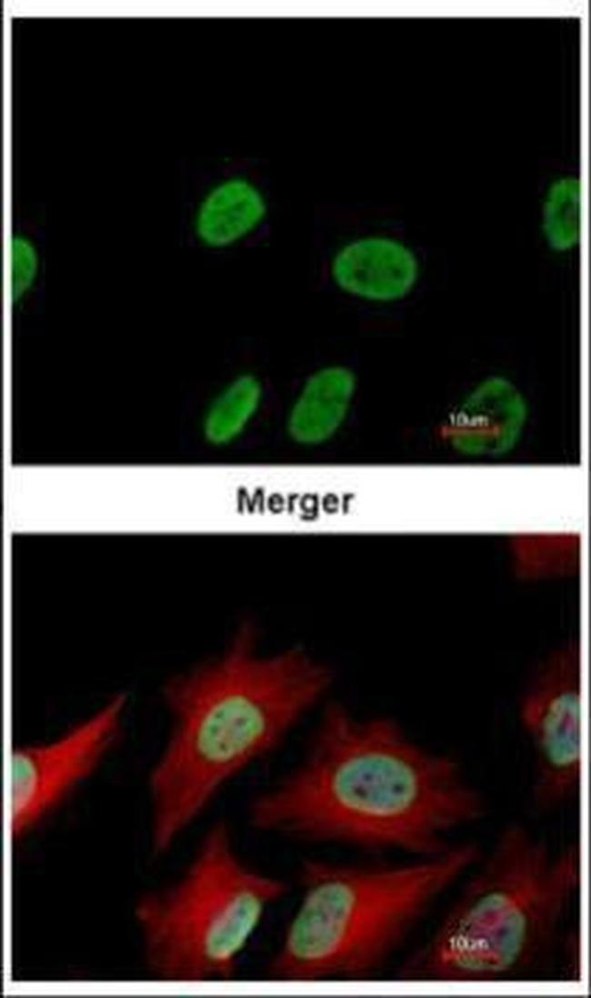 Ku70 Antibody in Immunocytochemistry (ICC/IF)