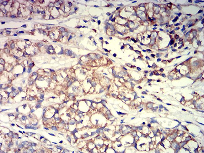 Arp3 Antibody in Immunohistochemistry (Paraffin) (IHC (P))