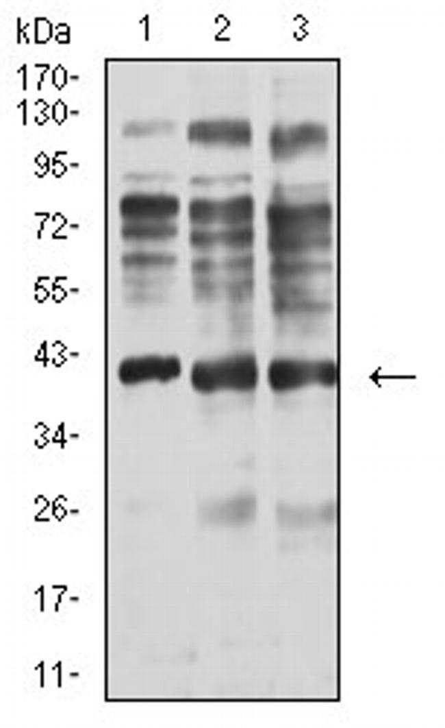 Centaurin alpha-1 Antibody in Western Blot (WB)