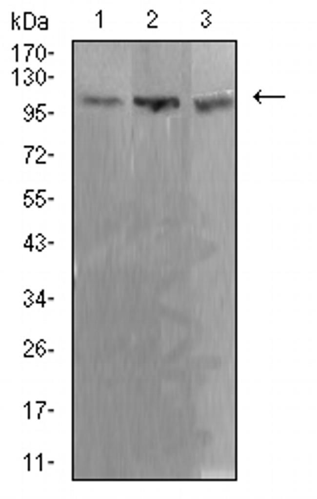 ADAR Antibody in Western Blot (WB)