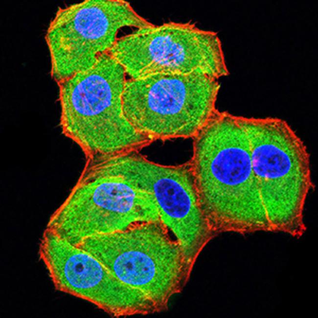 BCL11B Antibody in Immunocytochemistry (ICC/IF)