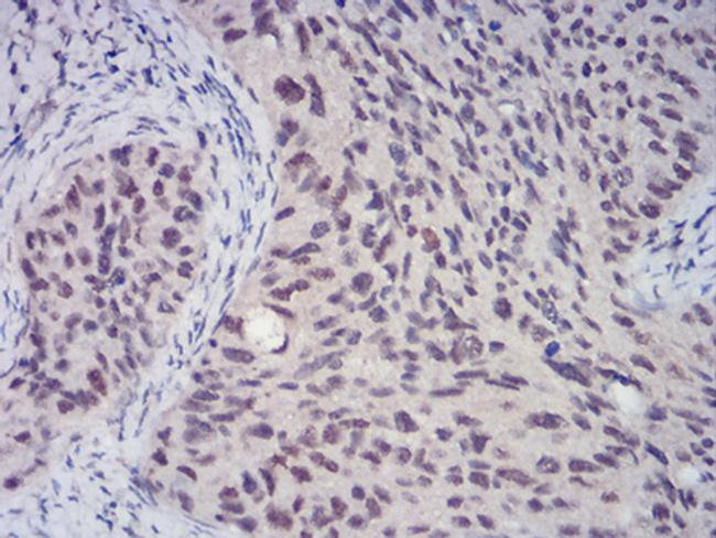 CBX4 Antibody in Immunohistochemistry (Paraffin) (IHC (P))