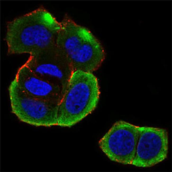 CK2 beta Antibody in Immunocytochemistry (ICC/IF)