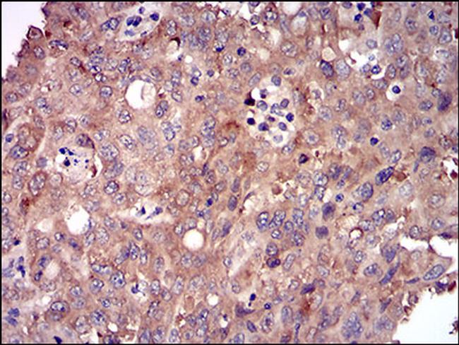 DIS3L2 Antibody in Immunohistochemistry (Paraffin) (IHC (P))