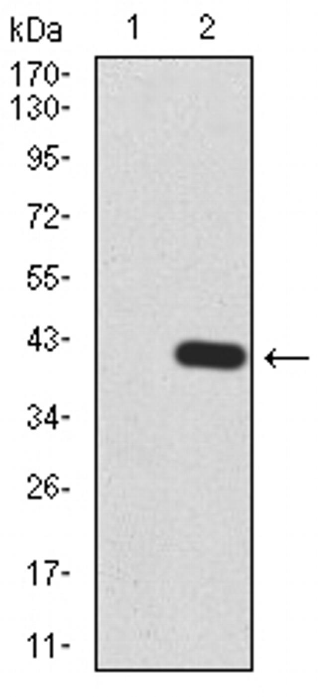 KDM5B Antibody in Western Blot (WB)