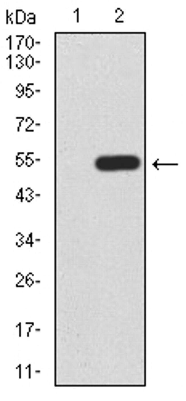 KLF6 Antibody in Western Blot (WB)