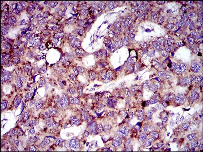 MRPL42 Antibody in Immunohistochemistry (Paraffin) (IHC (P))