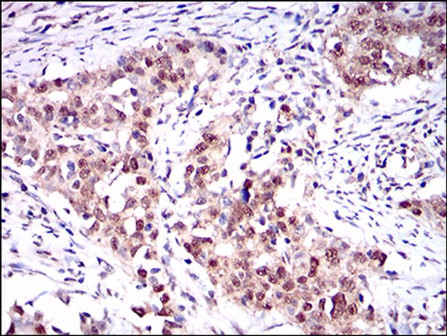 ONECUT3 Antibody in Immunohistochemistry (Paraffin) (IHC (P))