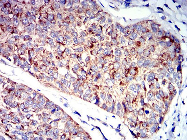 P2Y1 Antibody in Immunohistochemistry (Paraffin) (IHC (P))