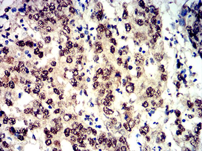 Phospho-4EBP1 (Ser65) Antibody in Immunohistochemistry (Paraffin) (IHC (P))