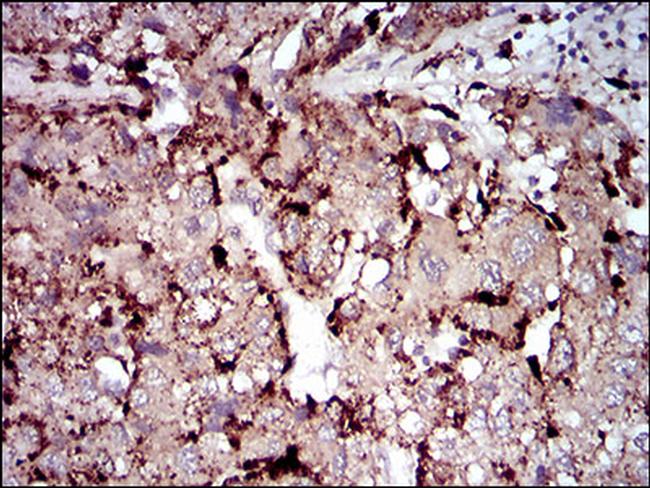 PLA2G12A Antibody in Immunohistochemistry (Paraffin) (IHC (P))