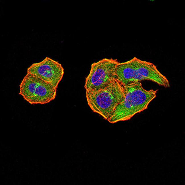 PTPN14 Antibody in Immunocytochemistry (ICC/IF)