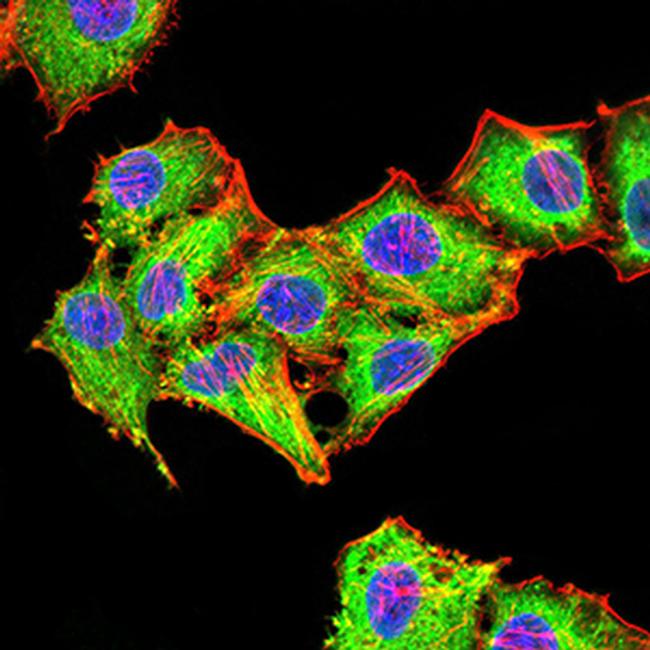 RAB6B Antibody in Immunocytochemistry (ICC/IF)