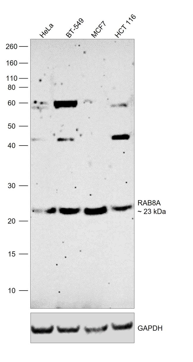 RAB8A Antibody in Western Blot (WB)