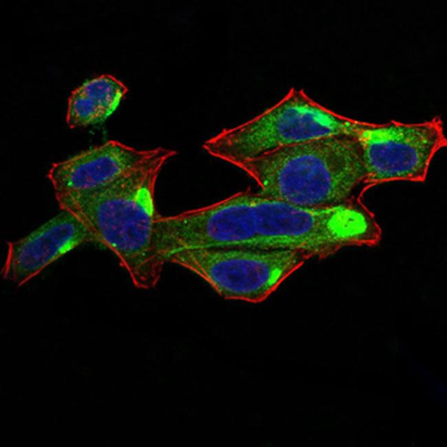 RALA Antibody in Immunocytochemistry (ICC/IF)