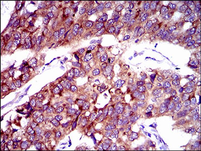 SLC27A2 Antibody in Immunohistochemistry (Paraffin) (IHC (P))