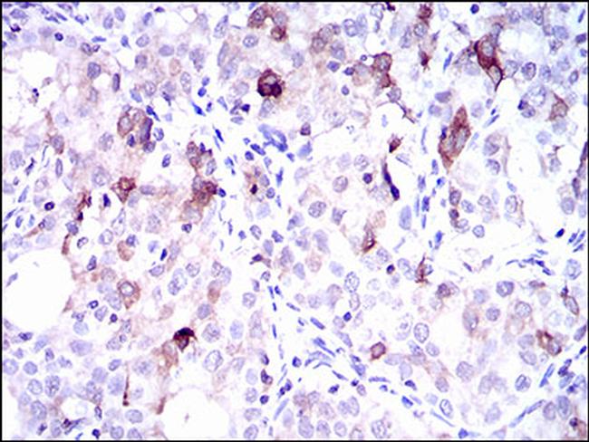 SLC27A5 Antibody in Immunohistochemistry (Paraffin) (IHC (P))