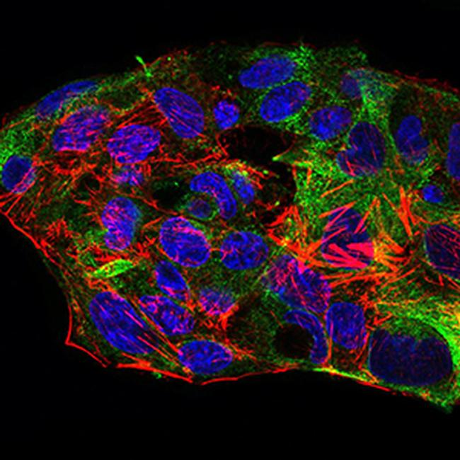 SCP3 Antibody in Immunocytochemistry (ICC/IF)