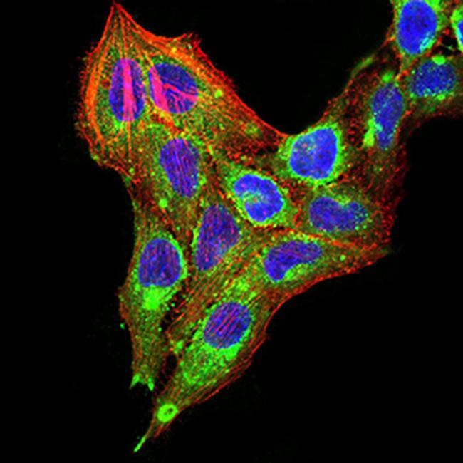 TTF1 Antibody in Immunocytochemistry (ICC/IF)