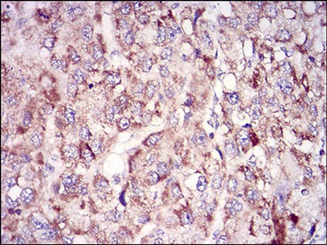 TUBE1 Antibody in Immunohistochemistry (Paraffin) (IHC (P))