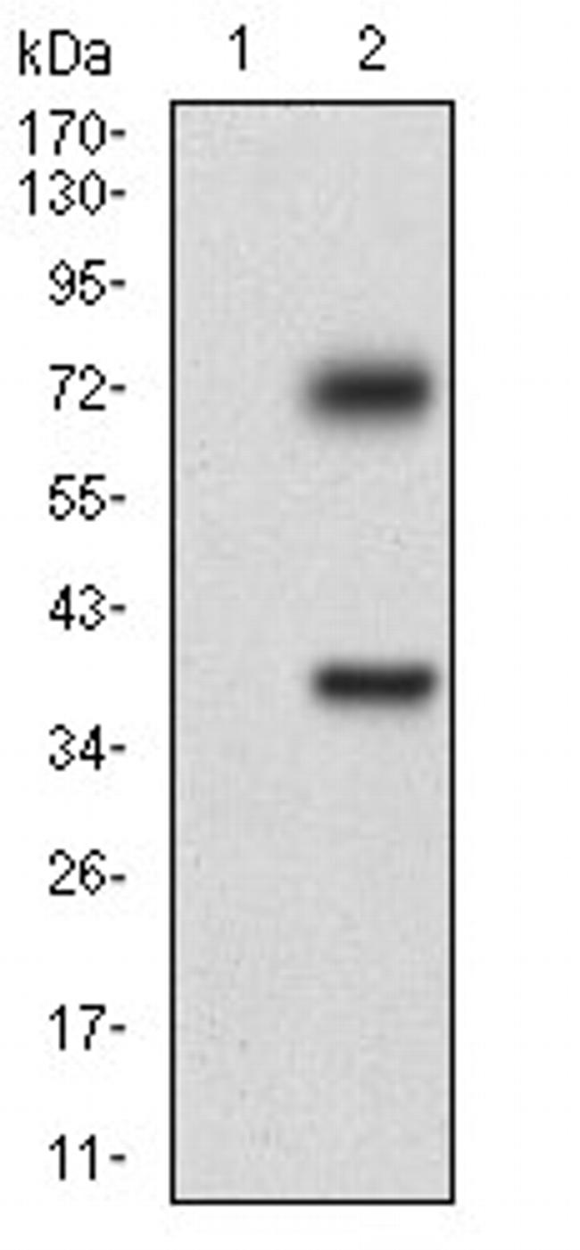 TUBE1 Antibody in Western Blot (WB)