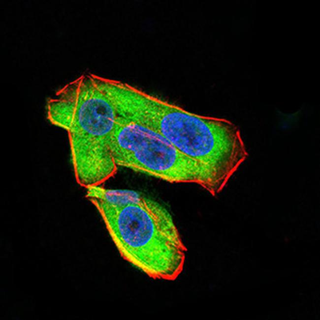 UCP2 Antibody in Immunocytochemistry (ICC/IF)