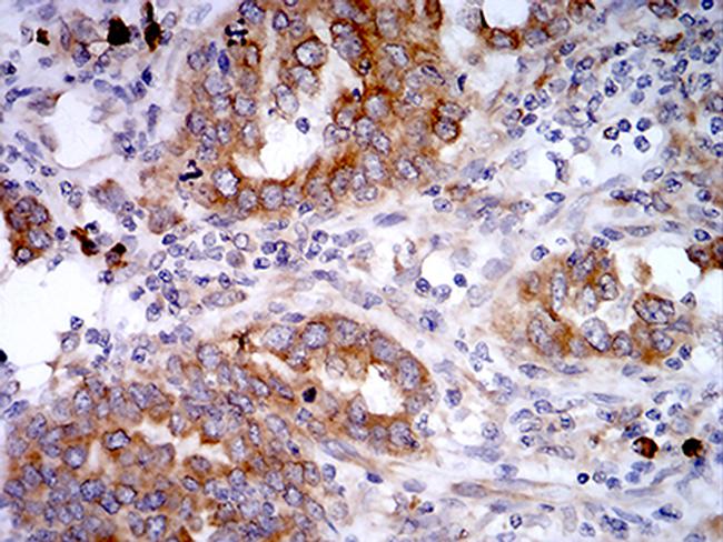 SELS Antibody in Immunohistochemistry (Paraffin) (IHC (P))