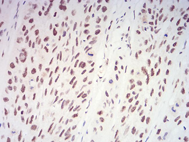 XRN2 Antibody in Immunohistochemistry (Paraffin) (IHC (P))