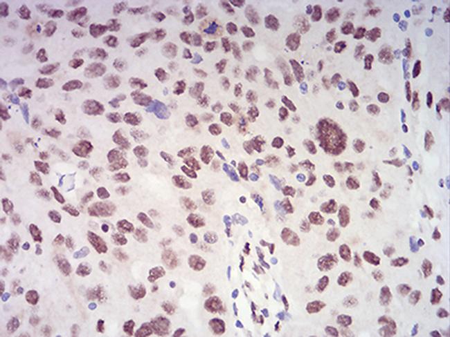 XRN2 Antibody in Immunohistochemistry (Paraffin) (IHC (P))