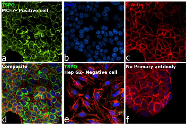 TSPO Antibody in Immunocytochemistry (ICC/IF)