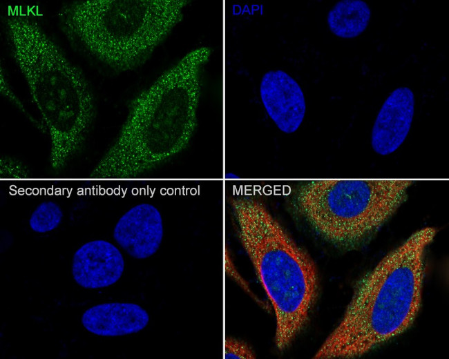 MLKL Antibody in Immunocytochemistry (ICC/IF)