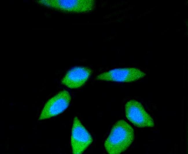 RPS3 Antibody in Immunocytochemistry (ICC/IF)