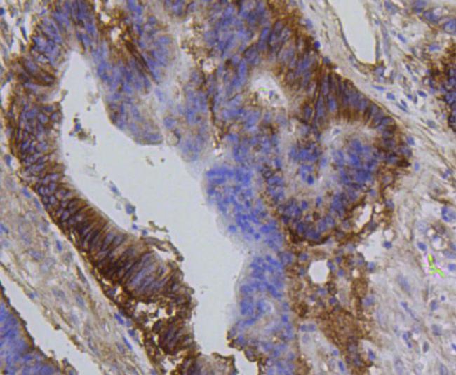 Integrin beta 1 (CD29) Antibody in Immunohistochemistry (Paraffin) (IHC (P))