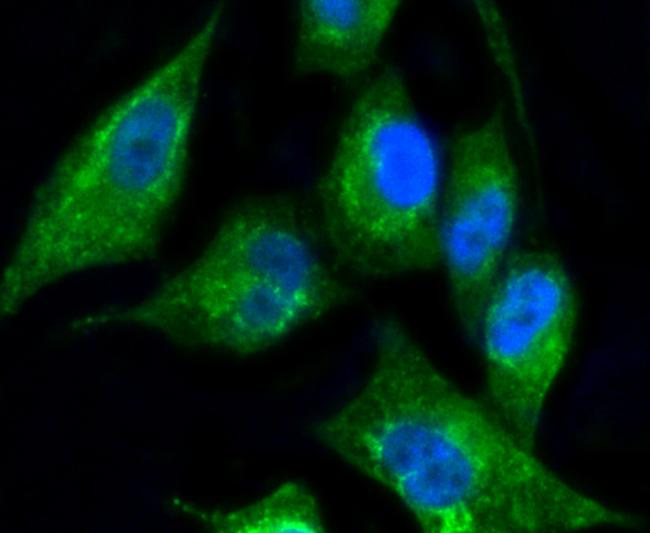 Cytokeratin 17 Antibody in Immunocytochemistry (ICC/IF)