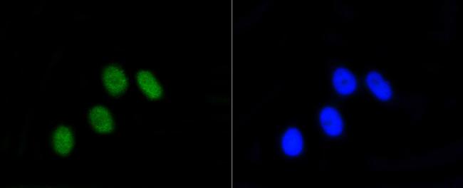 Phospho-Rb (Ser807) Antibody in Immunocytochemistry (ICC/IF)