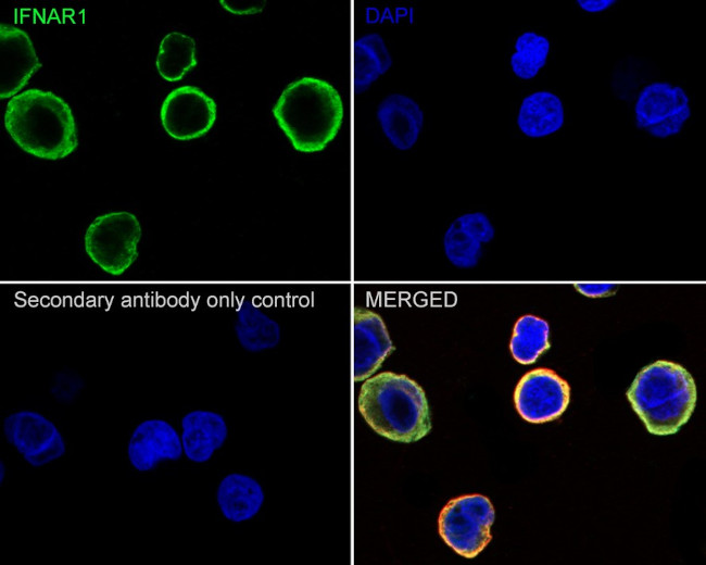 IFNAR1 Antibody in Immunocytochemistry (ICC/IF)