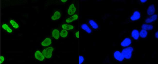 H4K5ac Antibody in Immunocytochemistry (ICC/IF)